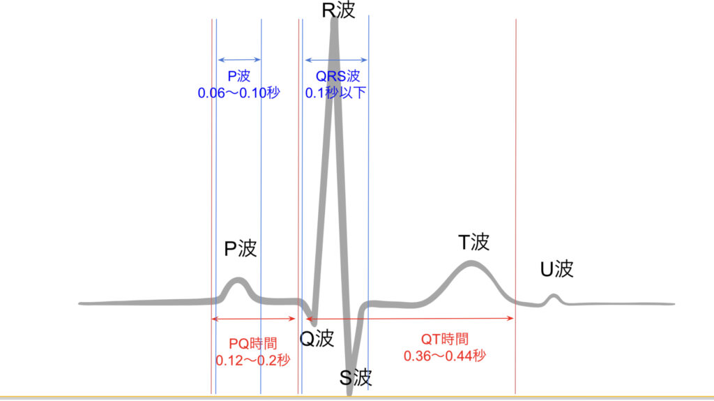 正常波形