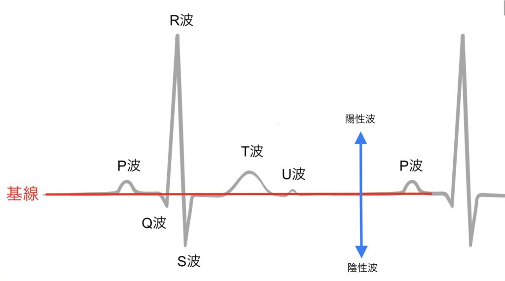 心電図