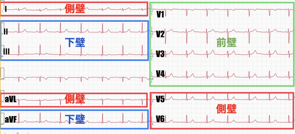 12誘導心電図の見方