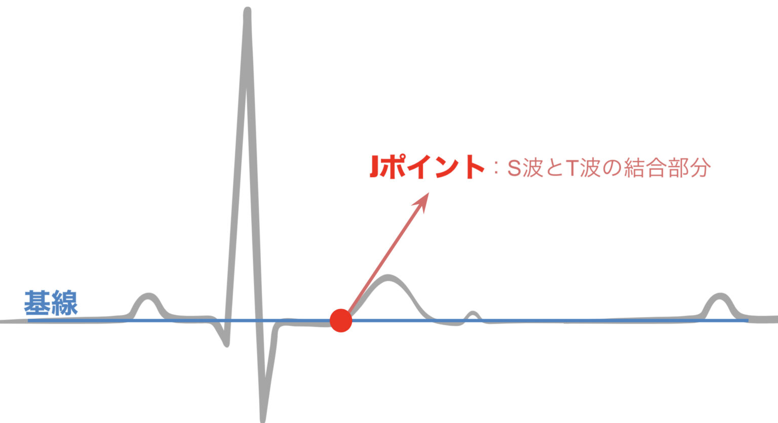 ST上昇・低下を示す心電図“Jポイント”について!心電図のわかりやすい見方! | 救急救命士キャリアップデート