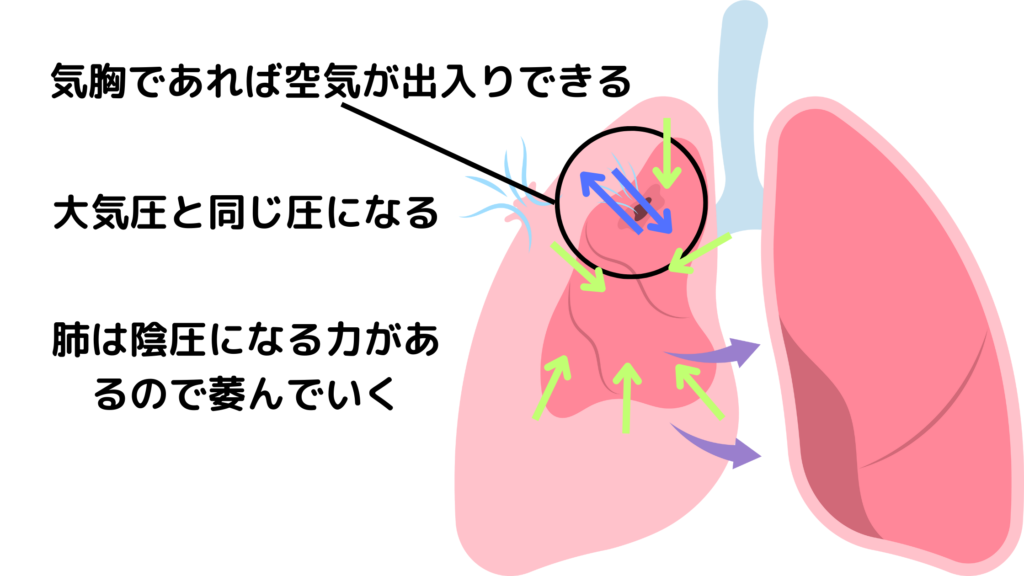 肺の解剖生理