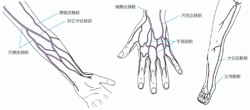 救急救命士が静脈路確保できる血管